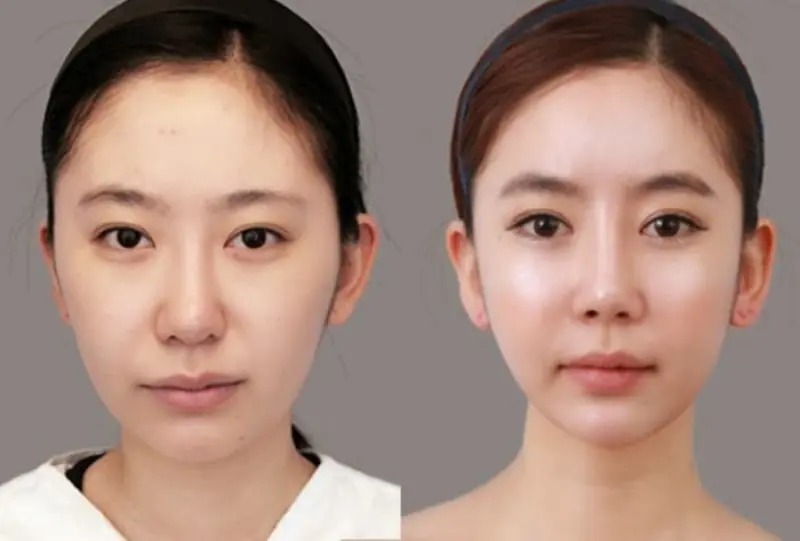 Trắng sáng – Căng bóng – Mờ thâm đa tầng Mandelic | 750.000₫