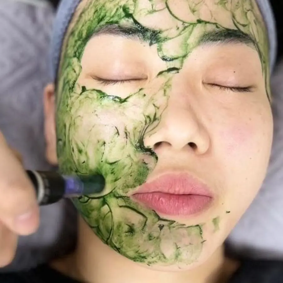 Cấy tảo Nano + Tế bào gốc EGF | 450.000₫